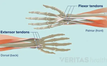 FIX WRIST PAIN: wrist stretches for prevention and healing