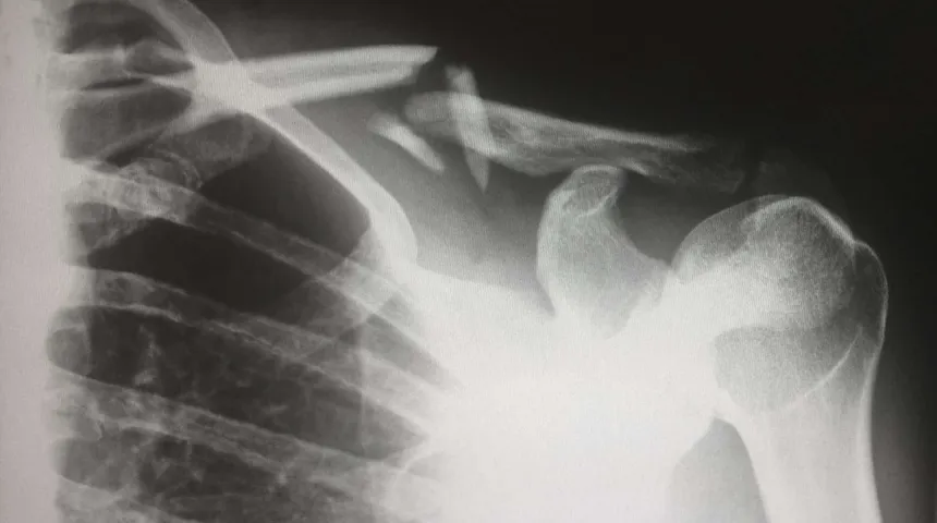 Most Common Injuries in Capoeira and why we Get Them