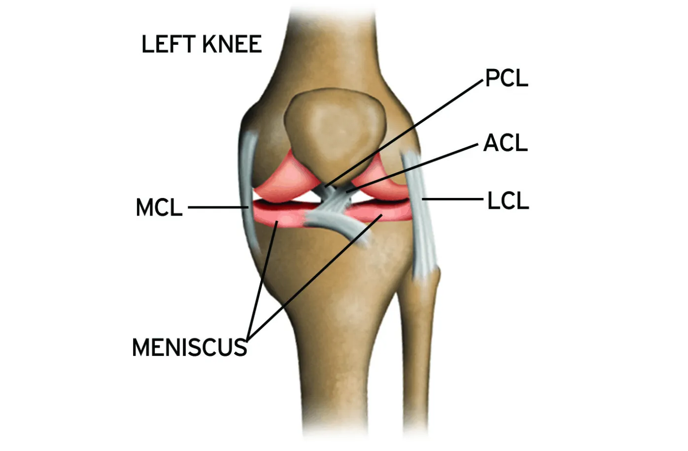 Capoeira Injury: Knee Pain During Negativa