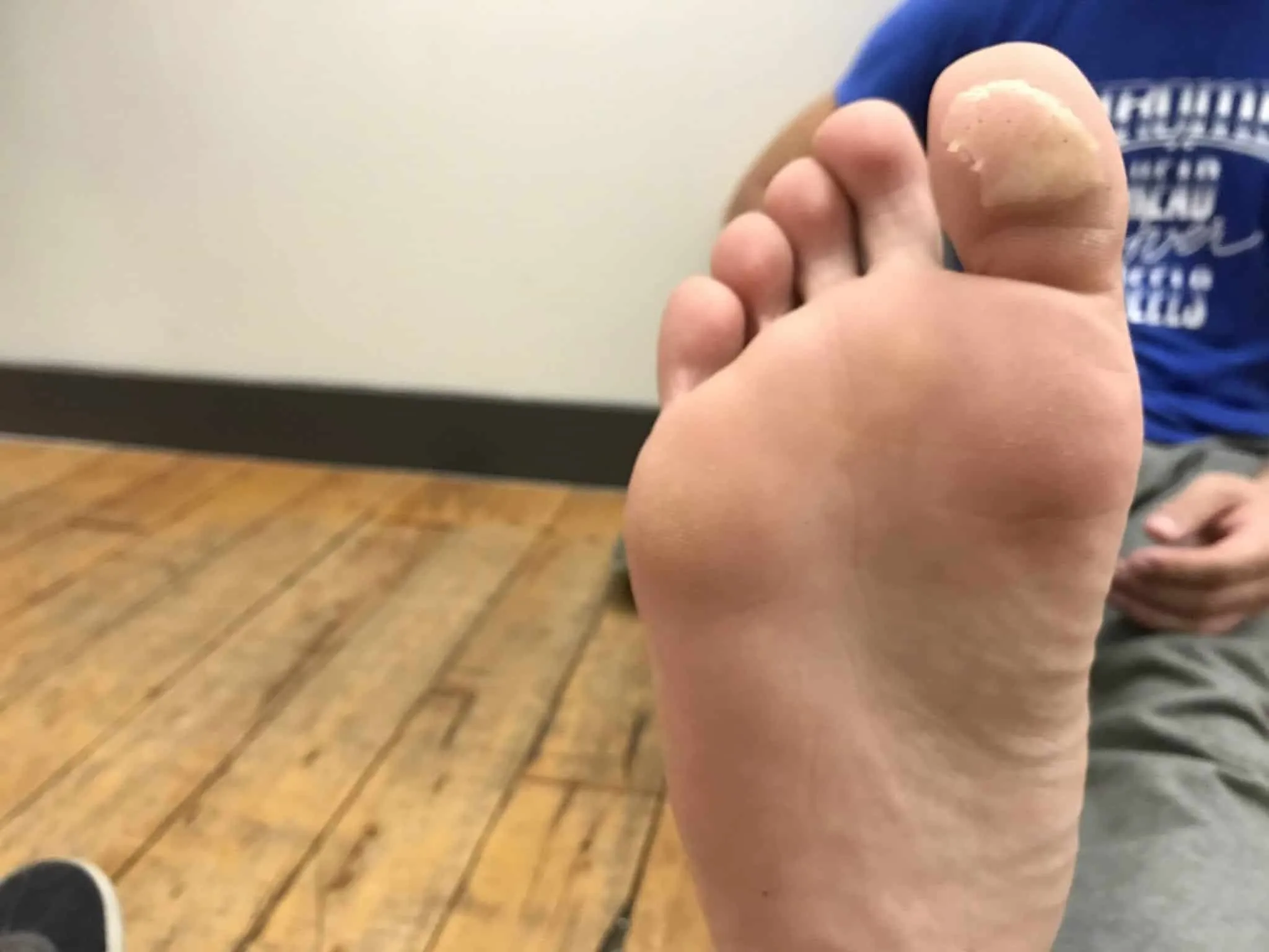 Prevent and Heal Foot Blisters: Capoeira, Dance, & Movers