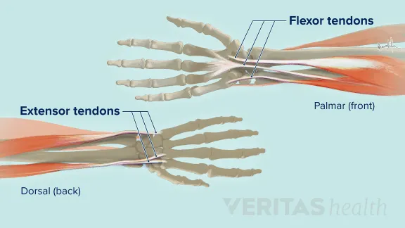 FIX WRIST PAIN: wrist stretches for prevention and healing